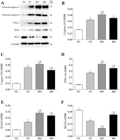 Synergistic Antitumor Effect Of BRMS1 And Sorafenib Via Inhibition Of