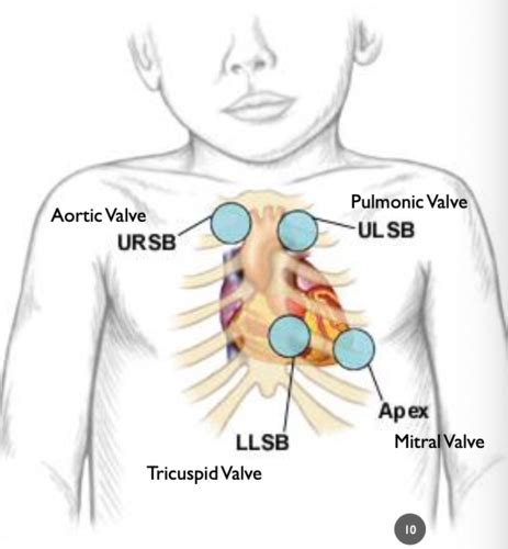 L Pediatric Cardio Flashcards Quizlet