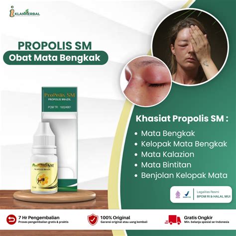 Jual Propolis SM Obat Mata Bengkak Mata Bintitan Mata Kalazion