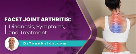 Facet Joint Arthritis: Diagnosis, Symptoms, and Treatment