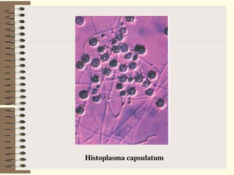 Ppt Pneumocystis Carinii Powerpoint Presentation Free Download Id3759200