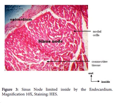 SA Node Histology