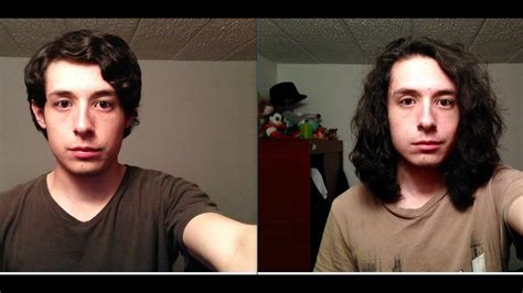 one year hair growth male - Awilda Rivas