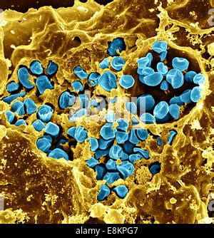 Scanning Electron Micrograph Of Murine Macrophage Infected With