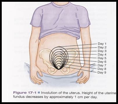 Block 3 OB Quiz 4 Postpartum Flashcards Quizlet