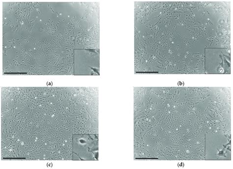 Phase Contrast Microscopic Photographs Depicting The Morphology Of The