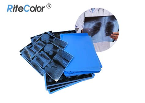 Inkjet Laser Printing X Ray Sheet Film Medical Dry Imaging Film 210