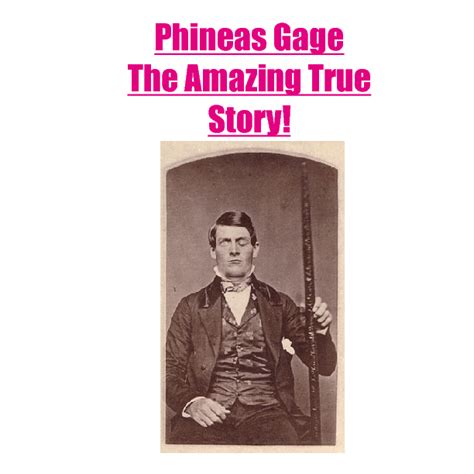 Phineas Gage - The Amazing True Story! | Book 235089