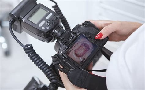 Fotografías dentales tipos y utilidades Enfoque Dental