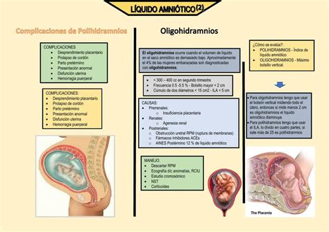 Complicaciones De Polihidramnios Y Oligohidramnios Mishelle Chavez