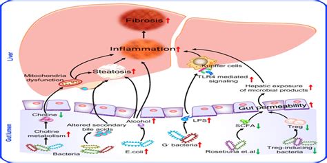 Sequencing the gut metagenome as a noninvasive diagnosis for ...