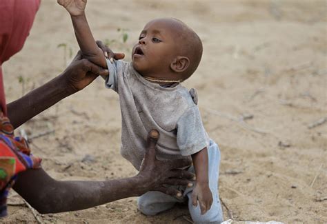 I Bambini Somali Muoiono Di Fame Il Post