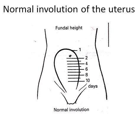 Fundus Of Uterus After Birth