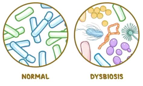 Gut Dysbiosis And Disease Flashcards Quizlet