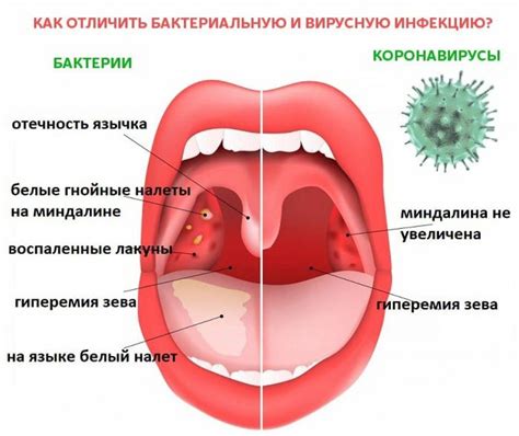 Herpes bolest v krku u dětí vše co potřebujete vědět o příčinách