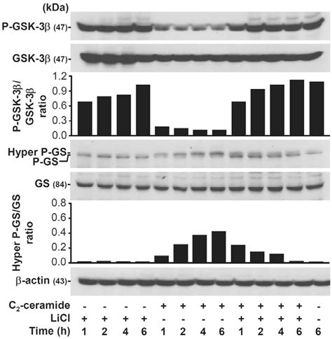 Figure From Gsk Acts Downstream Of Pp A And The Pi Kinase Akt