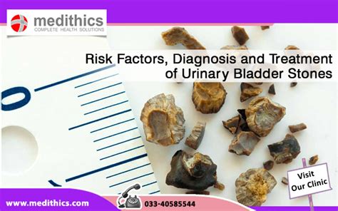 Risk Factors, Diagnosis and Treatment of Urinary Bladder Stones | Medithics Blog