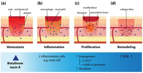 Toxins Free Full Text Botulinum Toxin Type A For The Treatment Of