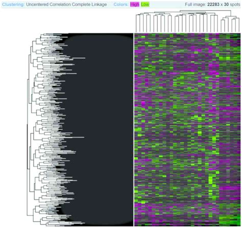 Differential Expression And Functional Analysis Of Lung Cancer Gene