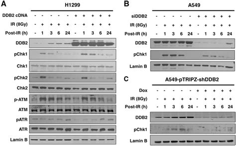 Ddb2 Increases Radioresistance Of Nsclc Cells By Enhancing Dna Damage