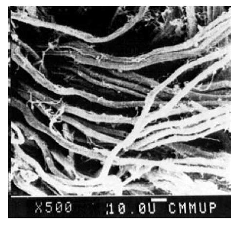 Sem Micrograph Of Internal Structure Of Leather Adapted With