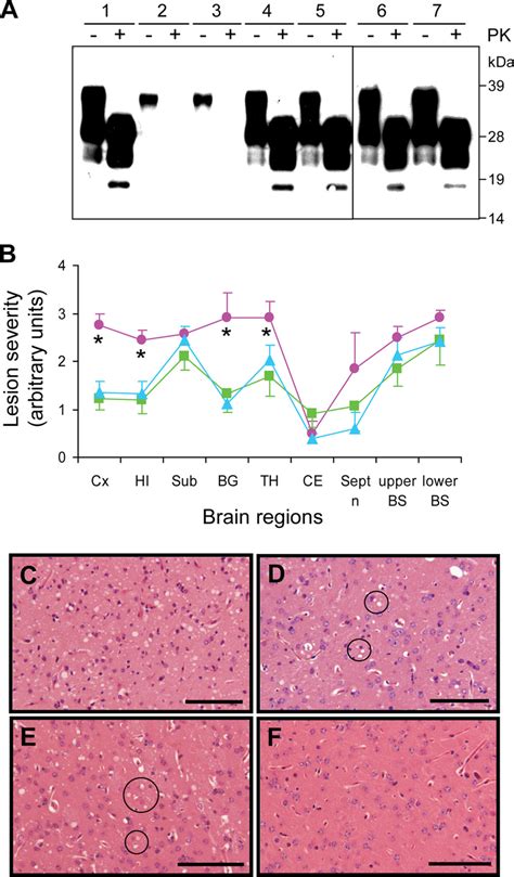 Characterization Of Prp Sc And Brain Histopathology Of Rshaprp Pmca