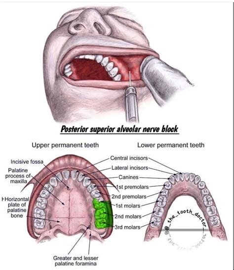 Posterior Superior Alveolar Nerve Medizzy