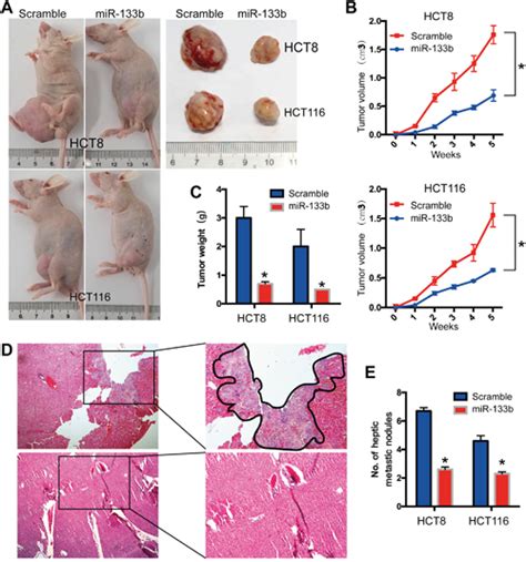 Mir 133b Suppresses Metastasis By Targeting Hoxa9 In Human Colorectal