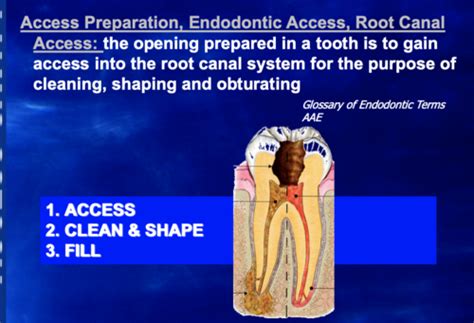 Access Cavity Preparation In Anterior Teeth Flashcards Quizlet