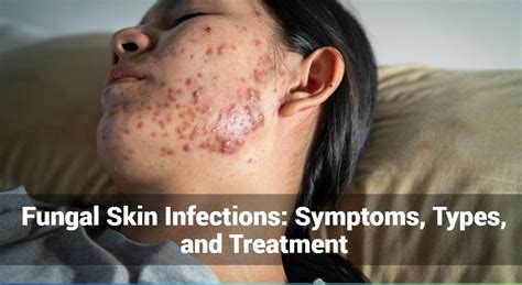 Navigating Skin Allergies Solutions Understanding Types Symptoms