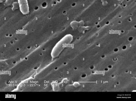 Vibrio Cholerae Microscope