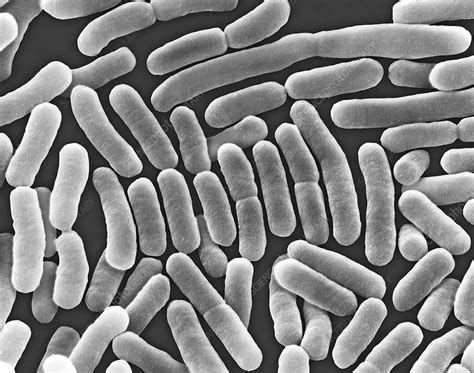 Salmonella Typhi Bacterium SEM Stock Image C037 0176 Science