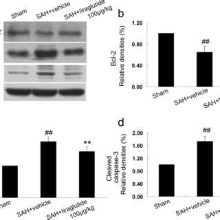 Effect of liraglutide on the expression of GLP 1R COX 2 iNOS TNF α