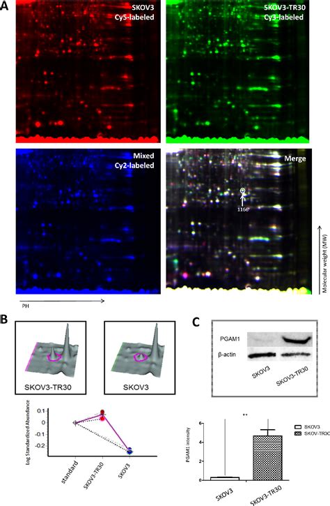 Figure From Pgam Promotes Glycolytic Metabolism And Paclitaxel