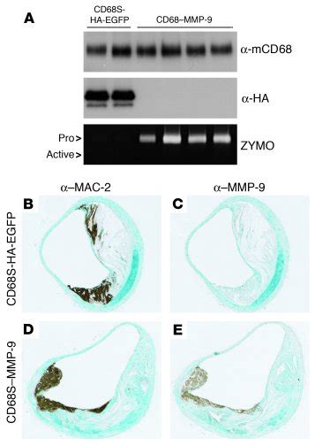 Jci Macrophage Expression Of Active Mmp 9 Induces Acute Plaque