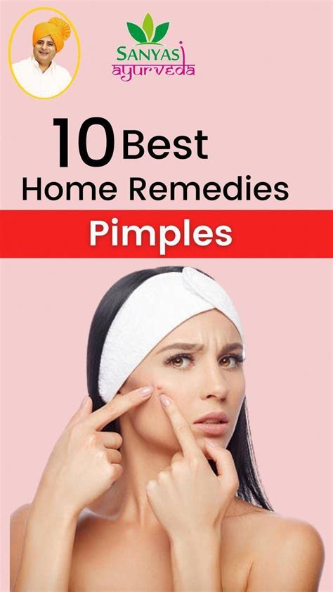 How To Get Rid Of Pimples 15 Home Remedies That Work Artofit