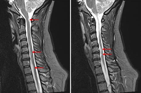 Case #13 - CaseStacks.com