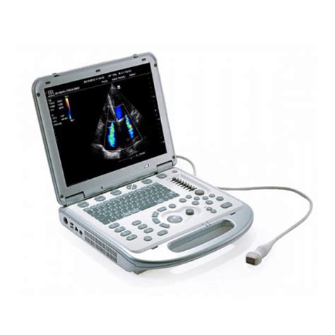 Портативный УЗИ аппарат Mindray M-7