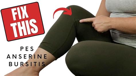 Pes Anserine Bursitis Knee Treatment Exercise To Reduce Pain Youtube