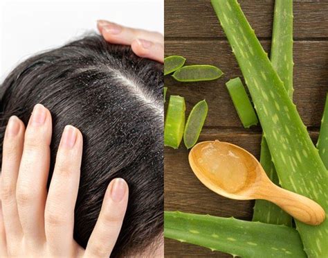 Intip Manfaat Lidah Buaya Untuk Kesehatan Rambut Sehat