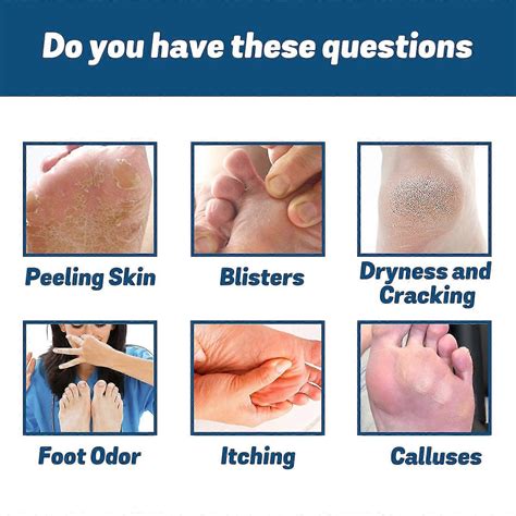 Medical Nail Fungus Foot Spray, Herbal Care Medical Grade Nail Foot