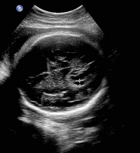 Pregnancy ultrasound Stock Images - Search Stock Images on Everypixel