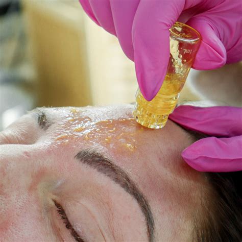 Get Radiant Skin With An Aqua Gold Facial Book Now