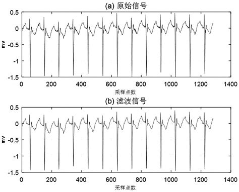 一种基于分段modwt及自适应阈值的动态心电图实时滤波方法与流程