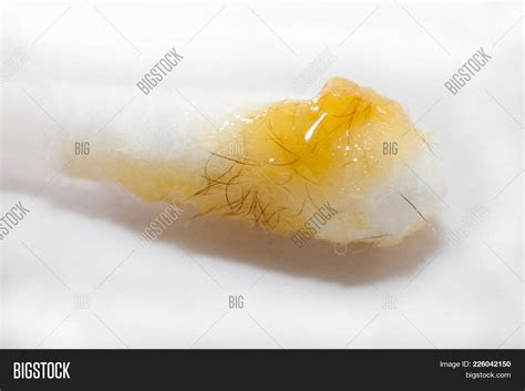 Macro Wet Ear Wax Hair Image & Photo (Free Trial) | Bigstock