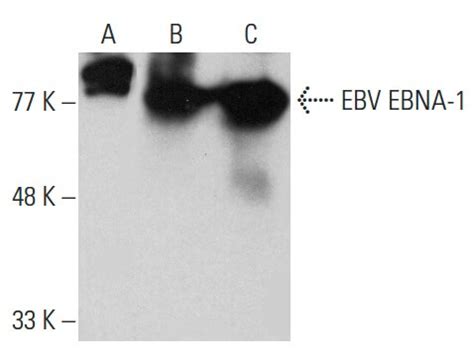 Anti EBV EBNA 1 Antibody 1EB12 SCBT Santa Cruz Biotechnology