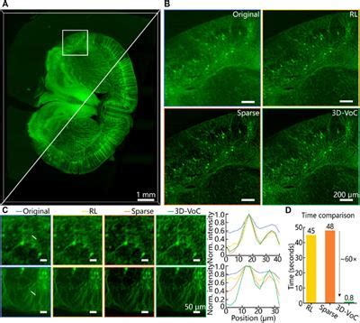 Frontiers Three Dimensional Virtual Optical Clearing With Cycle