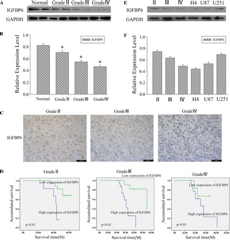 The Expression Of Igfbp In Human Glioma Tissues And Cell Lines And