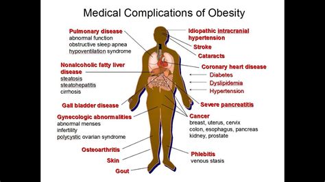 Nutrition Related Diseases Death Rates And Obesity Youtube