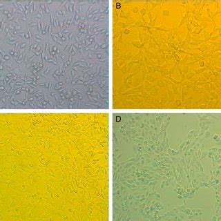 Effect Of Hypoxia And DMOG On Gene Expression In RCC10 And RCC4 Cells